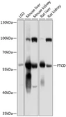 Anti-58K Golgi protein antibody used in Western Blot (WB). GTX66570