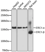 Anti-ELKS antibody used in Western Blot (WB). GTX66573