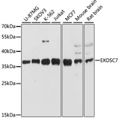Anti-EXOSC7 antibody used in Western Blot (WB). GTX66579