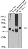 Anti-FBP2 antibody used in Western Blot (WB). GTX66583