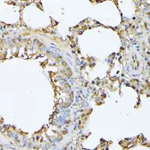 Anti-Proteasome 20S beta 3 antibody used in IHC (Paraffin sections) (IHC-P). GTX66592