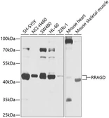 Anti-RRAGD antibody used in Western Blot (WB). GTX66595
