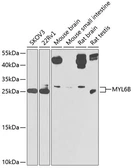 Anti-MLC1SA antibody used in Western Blot (WB). GTX66599