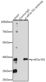 Anti-eIF2 alpha (phospho Ser51) antibody used in Immunoprecipitation (IP). GTX66600