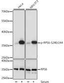 Anti-RPS6 (phospho Ser240/Ser244) antibody used in Western Blot (WB). GTX66604