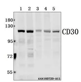 Anti-CD30 antibody used in Western Blot (WB). GTX66609