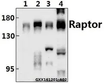 Anti-Raptor antibody used in Western Blot (WB). GTX66611