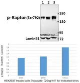 Anti-Raptor (phospho Ser792) antibody used in Western Blot (WB). GTX66614