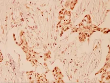 Anti-Cyclin E1 antibody used in IHC (Paraffin sections) (IHC-P). GTX66617