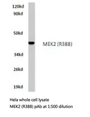 Anti-MEK2 antibody used in Western Blot (WB). GTX66622