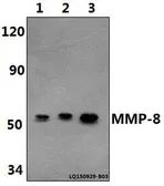 Anti-MMP8 antibody used in Western Blot (WB). GTX66623