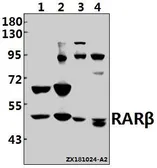 Anti-Retinoic Acid Receptor beta antibody used in Western Blot (WB). GTX66626