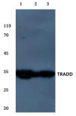 Anti-TRADD antibody used in Western Blot (WB). GTX66633