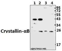 Anti-alpha B Crystallin antibody used in Western Blot (WB). GTX66638