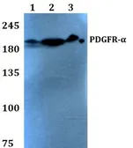 Anti-PDGF Receptor alpha antibody used in Western Blot (WB). GTX66642