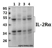 Anti-IL2 Receptor alpha antibody used in Western Blot (WB). GTX66646