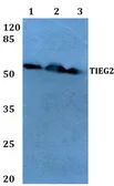 Anti-KLF11 antibody used in Western Blot (WB). GTX66649