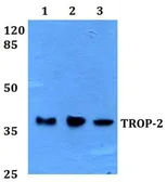 Anti-TACSTD2 antibody used in Western Blot (WB). GTX66651