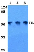 Anti-TEL antibody used in Western Blot (WB). GTX66653
