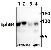 Anti-EphB4 antibody used in Western Blot (WB). GTX66654