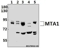 Anti-MTA1 antibody used in Western Blot (WB). GTX66656