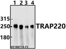 Anti-MED1 antibody used in Western Blot (WB). GTX66658