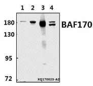 Anti-SMARCC2 / BAF170 antibody used in Western Blot (WB). GTX66659