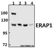 Anti-ERAP1 antibody used in Western Blot (WB). GTX66660