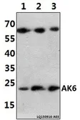 Anti-AK6 antibody used in Western Blot (WB). GTX66662