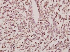 Anti-CYP24A1 antibody used in IHC (Paraffin sections) (IHC-P). GTX66663