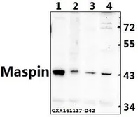 Anti-Maspin antibody used in Western Blot (WB). GTX66666