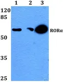 Anti-ROR alpha antibody used in Western Blot (WB). GTX66669