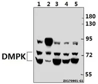 Anti-DMPK antibody used in Western Blot (WB). GTX66672