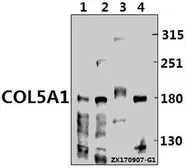 Anti-COL5A1 antibody used in Western Blot (WB). GTX66675