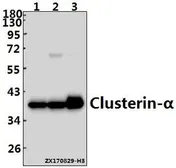 Anti-Clusterin alpha antibody used in Western Blot (WB). GTX66676