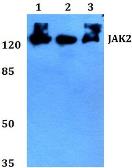 Anti-JAK2 antibody used in Western Blot (WB). GTX66678