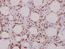 Anti-MUTYH antibody used in IHC (Paraffin sections) (IHC-P). GTX66680