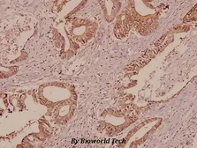 Anti-Galectin 7 antibody used in IHC (Paraffin sections) (IHC-P). GTX66682