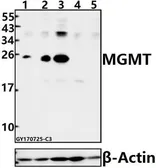 Anti-MGMT antibody used in Western Blot (WB). GTX66683