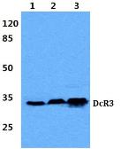 Anti-DcR3 antibody used in Western Blot (WB). GTX66684