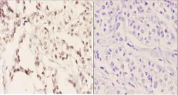 Anti-SFRS3 antibody used in IHC (Paraffin sections) (IHC-P). GTX66685