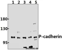 Anti-P-Cadherin antibody used in Western Blot (WB). GTX66687