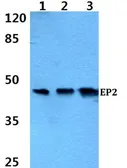 Anti-Prostaglandin E Receptor EP2 antibody used in Western Blot (WB). GTX66688