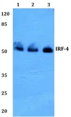 Anti-IRF4 / MUM1 antibody used in Western Blot (WB). GTX66692