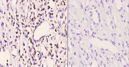 Anti-PMS2 antibody used in IHC (Paraffin sections) (IHC-P). GTX66694