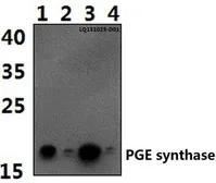 Anti-PTGES antibody used in Western Blot (WB). GTX66701