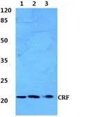Anti-CRF antibody used in Western Blot (WB). GTX66703