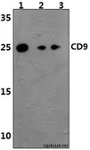 Anti-CD9 antibody used in Western Blot (WB). GTX66709
