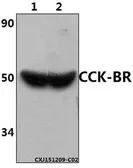 Anti-CCKBR antibody used in Western Blot (WB). GTX66711