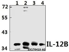 Anti-IL12B / IL12 p40 antibody used in Western Blot (WB). GTX66713